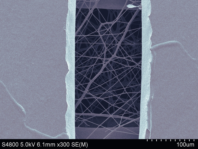 Scanning electron micrograph at 300 times magnification, scale bar 100 micrometres